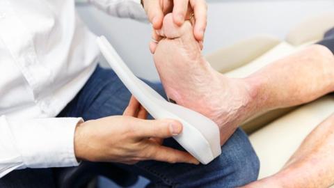 كيف يكون شكل جلطة الساق والأعراض الناتجة عنها